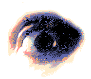 eye